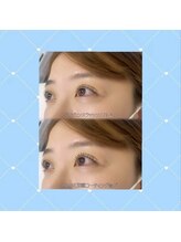 メメル 御影 住吉店(memelu)/まつげパーマ♪