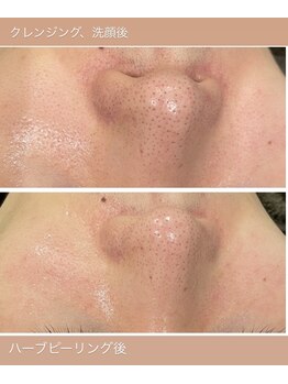 シャンディ(Shandy)/毛穴とくすみ悩みに即効対策!