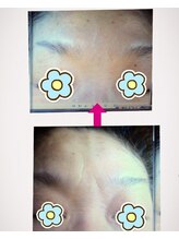 もみほぐし～ぷカンバラ(KAMBARA)/シワケアも◎