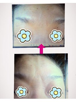 もみほぐし~ぷカンバラ(KAMBARA)/シワケアも◎