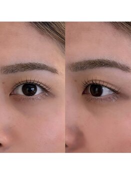 ユニブロウ 福岡天神(UNI BROW)/[福岡]ラッシュリフト／まつ毛