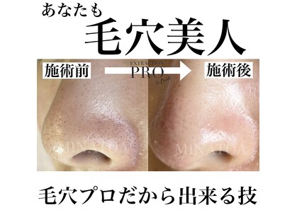 ミナトア(MINATOA)の写真
