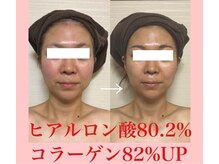 プルモア 蔵王店(PURU-MORE)/肌の中からふっくらハリを