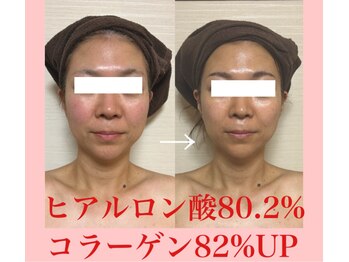 プルモア 蔵王店(PURU-MORE)/肌の中からふっくらハリを
