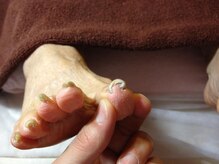 ピュアフット仙台駅前店/巻爪の主な原因【１】⇒