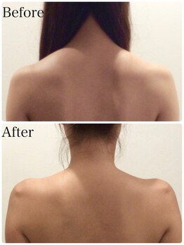 ビューティースタイリング 自由が丘店(beauty styling)/【ボディ】大人気肩まわり痩せ