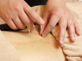 七彩鍼灸院/【鍼灸/美容鍼/恵比寿/代官山】