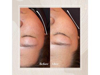 サラサ ビューティーサロン(SARASA)/フェイスアップマッサージ