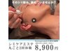 【Instagram広告予約用】人気No１レーザーじゃない最新シミケア70分2回¥8900