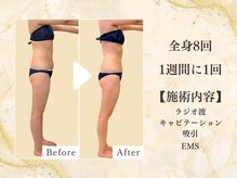 ミスティア(mistia)/【セルフエステBA】全身