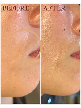 トータルビューティサロン シェリ(cheri)/人気のフェイシャルエステ