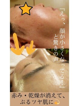 スイートボイス(sweet voice)/お顔を変えるスピード最速の施術
