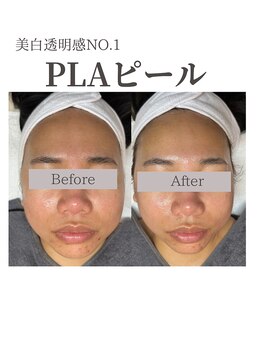 フォルディオ(FORDIO)/プラモード