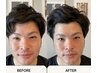 【フェイシャル】小顔＆むくみに効果絶大◎一度で結果出しが大人気！
