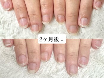 グレースレディ/(深爪/長さだし/フィルイン)