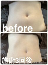 ギンザアール(GINZA R.)/