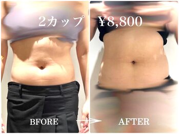 シフト 原宿店(SHIFT)/新規必見!2カップ/8800