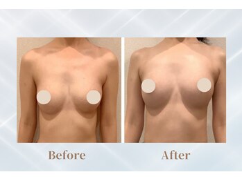 ふじこのみらい by ラディアンヌ/