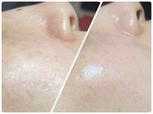 ソルエユニーク(Le seul et unique)の雰囲気（幅広い年代の多様な悩みを改善できるハーブピーリング★）