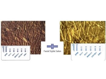 フェイシャルスタイリストサロン 四谷店/ケア例(56)