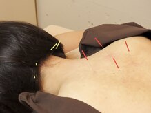 七彩鍼灸院/【鍼灸/美容鍼/恵比寿/代官山】