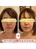 【とにかく小顔に】スーパー小顔フェイシャル70分￥13200