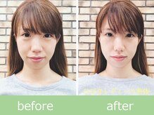 ひびきレディース整体 日吉/小顔×透明感！花嫁フェイス革命