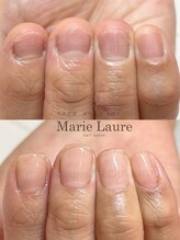 マリーロール 淀屋橋本店(Marie Laure)/自爪育成/深爪矯正/ネイルケア
