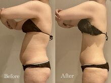 エステティック ミュー(Esthetic MiEUX)/全身痩せコース