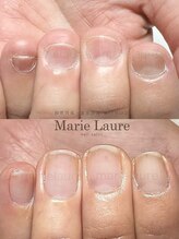 マリーロール 梅田店(Marie Laure)/深爪矯正/自爪育成/ネイルケア