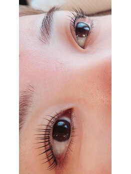 コア(Koa)/上下パリジェンヌリフト