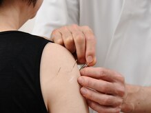 こさつ鍼灸治療院/