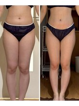 パルティール 恵比寿店(partir)/出せる！脚に♪♪