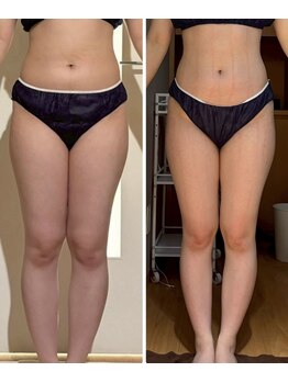 パルティール 恵比寿店(partir)/出せる！脚に♪♪