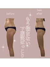 ソワン 小岩店(Soin)/50代　中半身