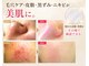 サロンドエステケイワイ(de KY)の写真