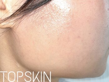トップスキン 名駅(TOPSKIN)/ノーファンでが叶う♪うるツヤ肌
