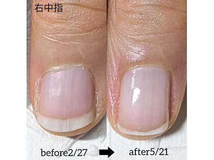 リコネイル(riconail)の写真