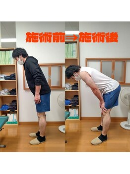 シャロームカイロプラクティックおおば/急な腰痛【整体・マッサージ】