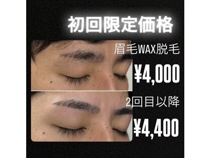 脱毛サロン メンズ 堂々の写真