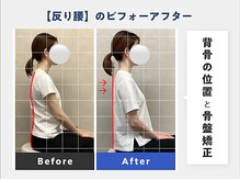 鹿児島中山整体院/1度の施術でこの変化◎