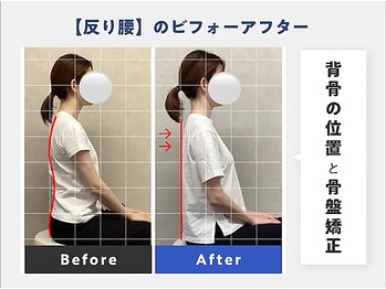 鹿児島中山整体院/1度の施術でこの変化◎