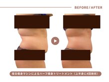 イエス マイサロン(yes My Salon)/ハーフ痩身トリートメント症例
