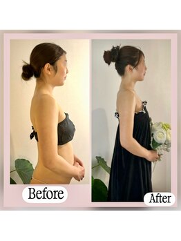 蒼(so)/【8回】体重-6キロ！二の腕－5cm