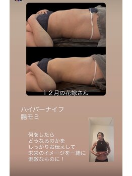 ジーニー(Genie)/ハイパーナイフ＆腸もみ