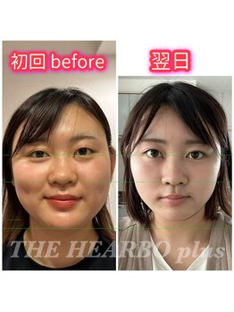 ハーボプラス(THE HEARBO plus)/絶対小顔にしたい!!