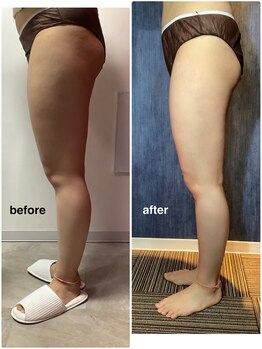 カナウ(kanau)/トリプルボディシェイプ