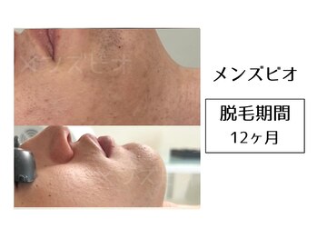 メンズビオ 神戸三宮店/