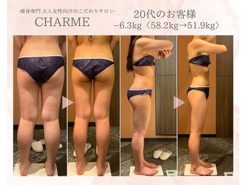 シャルム(charme)/結果出しハイパーナイフ痩身
