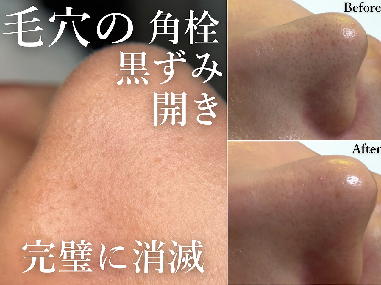 特別割引き【毛穴の黒ずみ角栓に】ハイドラフェイシャル毛穴洗浄マシン/新品未使用 特別割引き【毛穴の黒ずみ角栓に】ハイドラフェイシャル毛穴洗浄マシン